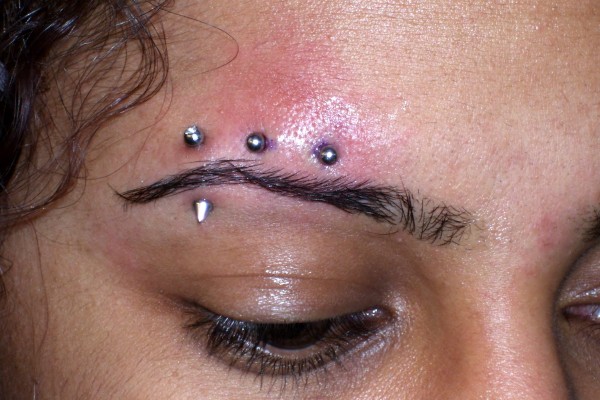 Healing after an eyebrow piercing.